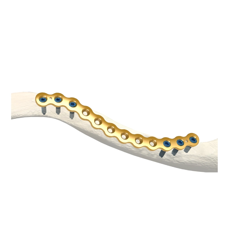 Orthopedic Implants Titanium Bone Plate 3.5mm Reconstruction Clavicle LCP